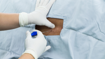CRNA works to bring epidural anesthesia to Kenya
